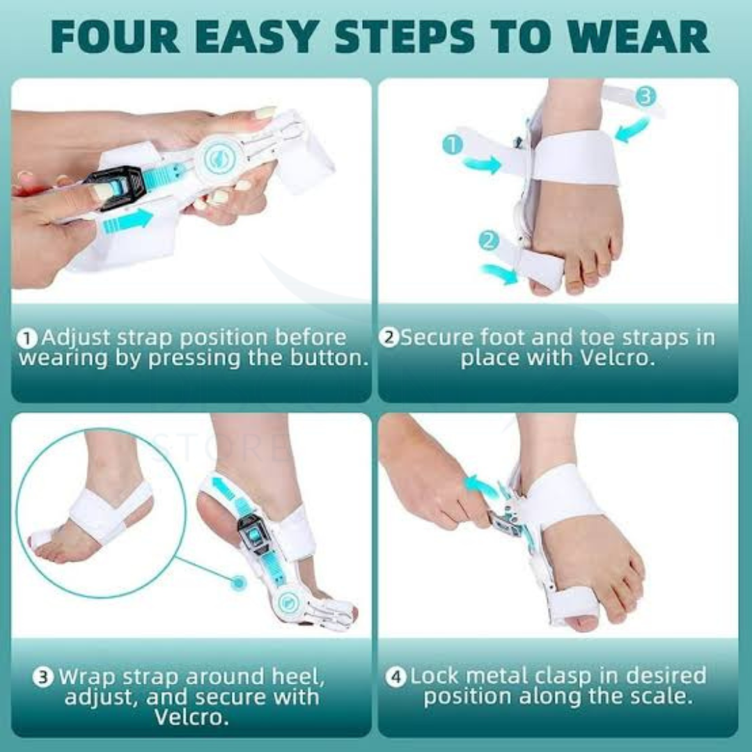 Pain Relief Bunion Toe Corrector™ - (IMPORTED)