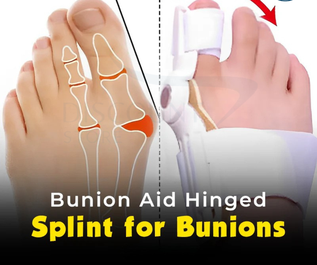 Pain Relief Bunion Toe Corrector™ - (IMPORTED)